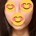 エレクトロポレーション / RF（高周波）たるみ治療 Days Beauty Clinic 新宿院 DAY 6 サムネイル用
