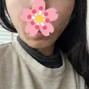 糸リフト / 肌ヒアルロン酸注入（たるみ・シワ改善） BON BON CLINIC 銀座駅前本院 DAY 0 サムネイル用