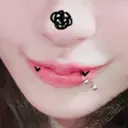 その他（鼻） / その他（輪郭） / その他 ルラ美容クリニック 大阪本院 DAY 2 サムネイル用