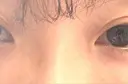 その他（目元） BRIGHTS beauty clinic DAY 10 サムネイル用