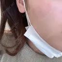 ルメッカ Moon Beauty Clinic AFTER サムネイル用