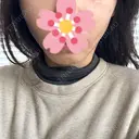 糸リフト / 肌ヒアルロン酸注入（たるみ・シワ改善） BON BON CLINIC 銀座駅前本院 AFTER サムネイル用