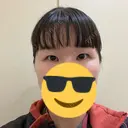 二重埋没 / 上まぶたの脂肪取り 東京イセアクリニック AFTER サムネイル用