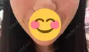 その他（口元） 川崎かかりつけクリニック AFTER サムネイル用