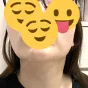 インモード おおかみ美容のクリニック 新宿院 AFTER サムネイル用