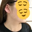 インモード おおかみ美容のクリニック 新宿院 DAY 6 サムネイル用