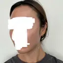 ボトックス（エラ・小顔） / ヒアルロン酸注入（額） / ヒアルロン酸注入（頬） / デンシティ フィラークリニック 新宿院 DAY 1 サムネイル用