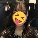バッカルファット除去 / 脂肪吸引（顔） / ボトックス（エラ・小顔） / ヒアルロン酸注入（額） エートップ美容整形外科 DAY 106 サムネイル用