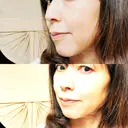 インモード / オンダリフト RIVER CLINIC（リバークリニック） DAY 11 サムネイル用