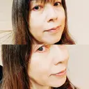 インモード / オンダリフト RIVER CLINIC（リバークリニック） DAY 11 サムネイル用