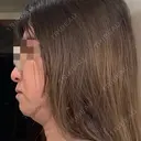 オンダリフト Wing clinic 豊中駅前院 AFTER サムネイル用