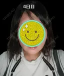 糸リフト / 脂肪吸引（顔） Days Beauty Clinic 新宿院 AFTER サムネイル用