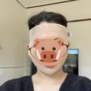 脂肪吸引（顔） Casa de GRACIA GINZA 【カーサデグラシアギンザ】 DAY 1 サムネイル用