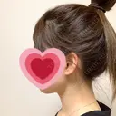 脂肪吸引（顔） R Beauty CLINIC 銀座院 DAY 28 サムネイル用