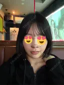 隆鼻術 / 鼻尖形成（切開） / 鼻中隔延長（切開） / 小鼻縮小（切開） / 軟骨移植 / 鼻修正 / 鼻孔縁下降 シンデレラ＆ダヴィンチクリニック DAY 6 サムネイル用