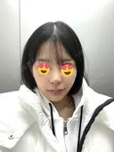 隆鼻術 / 鼻尖形成（切開） / 鼻中隔延長（切開） / 小鼻縮小（切開） / 軟骨移植 / 鼻修正 / 鼻孔縁下降 シンデレラ＆ダヴィンチクリニック DAY 7 サムネイル用