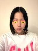 隆鼻術 / 鼻尖形成（切開） / 鼻中隔延長（切開） / 小鼻縮小（切開） / 軟骨移植 / 鼻修正 / 鼻孔縁下降 シンデレラ＆ダヴィンチクリニック DAY 59 サムネイル用
