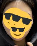 二重埋没 / 糸リフト 銀座みゆき通り美容外科 大阪梅田院 DAY 15 サムネイル用