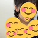 オンダリフト 湘南美容クリニック 大阪梅田本院 AFTER サムネイル用