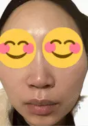 ルメッカ La Fee Clinic DAY 1 サムネイル用