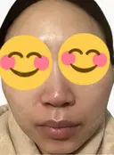 ルメッカ La Fee Clinic DAY 2 サムネイル用