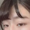 二重切開 / 眼瞼下垂（切開） 広島プルミエクリニック DAY 94 サムネイル用