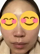 ルメッカ La Fee Clinic DAY 4 サムネイル用