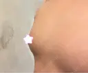 豊胸（脂肪注入） 銀座マイアミ美容外科 DAY 28 サムネイル用