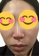ルメッカ La Fee Clinic DAY 5 サムネイル用