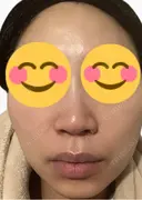 ルメッカ La Fee Clinic DAY 6 サムネイル用