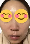 ルメッカ La Fee Clinic DAY 7 サムネイル用
