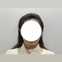 脂肪吸引（顔） HAAB BEAUTY CLINIC 南青山本院（新院） DAY 28 サムネイル用
