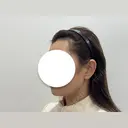 脂肪吸引（顔） HAAB BEAUTY CLINIC 南青山本院（新院） DAY 28 サムネイル用