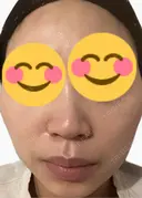 ルメッカ La Fee Clinic DAY 8 サムネイル用