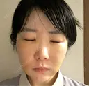 糸リフト / クマ治療 / バッカルファット除去 / 脂肪吸引（顔） / ジョールファット除去 / ネックリフト BLINC CLINIC （ブリンク クリニック） DAY 6 サムネイル用