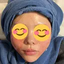 水光注射（ハリ・美肌） REVI CLINIC銀座院  DAY 0 サムネイル用
