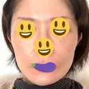 切開リフト GRACY TOKYO CLINIC【グレイシートウキョウクリニック】 DAY 16 サムネイル用