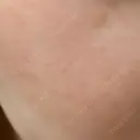 ルメッカ 大美会クリニック 岡山院 AFTER サムネイル用