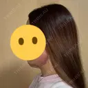 その他（輪郭） おおかみ美容のクリニック 新宿院 DAY 0 サムネイル用