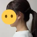 その他（輪郭） おおかみ美容のクリニック 新宿院 AFTER サムネイル用