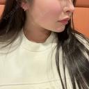 バッカルファット除去 / 脂肪吸引（顔） / あご下筋肉縛り セギム美容整形外科 DAY 91 サムネイル用
