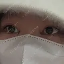 目頭切開 HAAB×DREAM BEAUTY CLINIC 大阪梅田院 DAY 2 サムネイル用