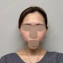 オンダリフト LIGHT CLINIC 【ライトクリニック】 新宿院 DAY 0 サムネイル用
