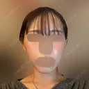 オンダリフト LIGHT CLINIC 【ライトクリニック】 新宿院 DAY 3 サムネイル用