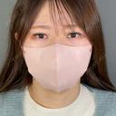 二重埋没 / 上まぶたの脂肪取り アリエル美容クリニック 郡山院 AFTER サムネイル用