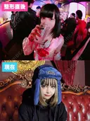 二重埋没 / 目頭切開 / 小鼻縮小（切開） / 糸リフト / 人中短縮 / タレ目形成・グラマラスライン（切開） / 鼻尖縮小 / ヒアルロン酸注入（鼻） / ヒアルロン酸注入（あご） / ヒアルロン酸注入（唇） / ピーリング（ニキビ・毛穴） / イオン導入 / 美肌レーザー / 美白レーザー 銀座TAクリニック DAY 242 サムネイル用