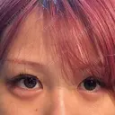 ヒアルロン酸注入（涙袋） / ボトックス（あご） / ヒアルロン酸注入（あご） / ボトックス（エラ・小顔） 博多美容外科/美容皮膚科 ビラビューティークリニック DAY 0 サムネイル用
