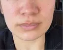 ポテンツァ 日比谷セントラルクリニック DAY 2 サムネイル用