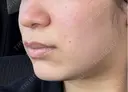 ポテンツァ 日比谷セントラルクリニック DAY 2 サムネイル用