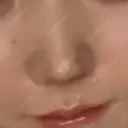 スレッドノーズ 渋谷美容外科クリニック 渋谷院 AFTER サムネイル用